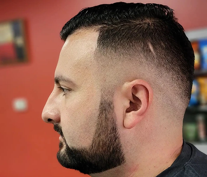 Fades